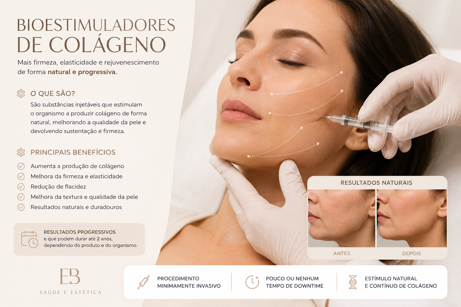 Bioestimuladores
