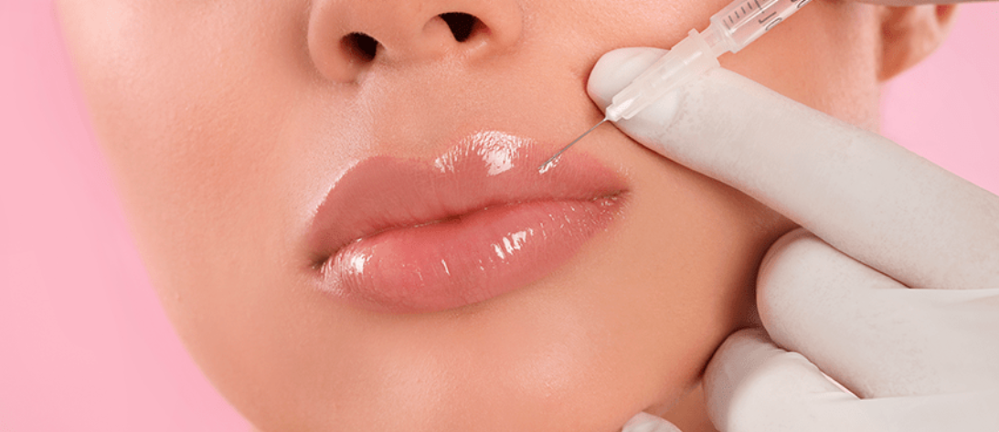 Preenchimento Labial